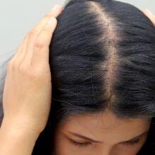 Hair Marks