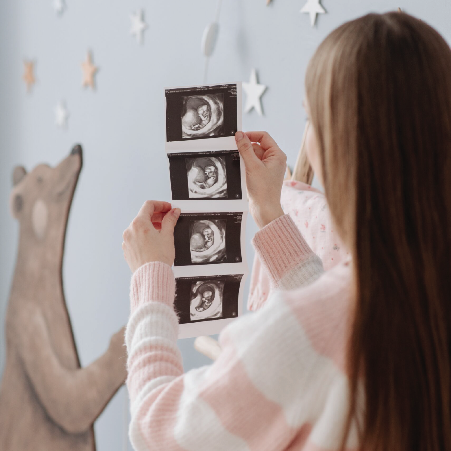 A pregnant mom watching her scan pictures A pregnant mom watching her scan pictures
