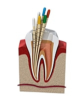 NeoEndo Gutta Percha Points 4% Length Marked – Root Canal GP Points