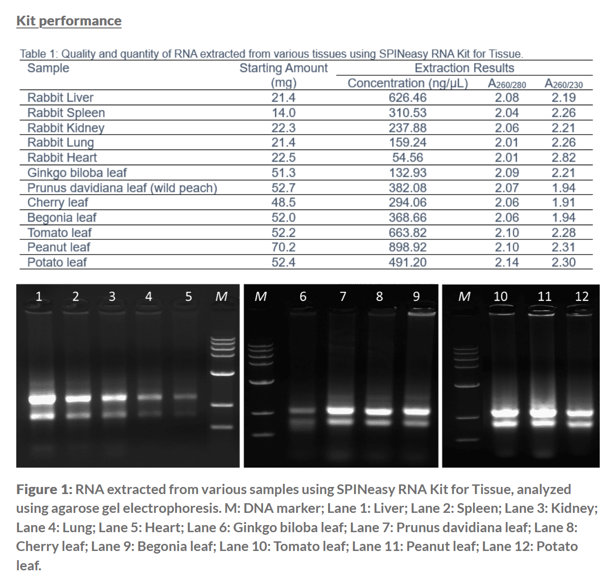 SPINeasy® RNA Kit for Tissue (Without Lysing Matrix) 50preps MP