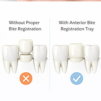 Oro Bite Registration & Impression Trays – Disposable Dental Trays