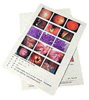 Inkjet Medical WHITE Film 8"X10" DR/CR/MRI/CT Imaging Film 175 Micron / 240 gsm 100 SHEETS Inkjet Medical WHITE Film 8"X10" DR/CR/MRI/CT Imaging Film 175 Micron / 240 gsm 100 SHEETS