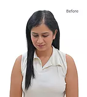 1.5" X 3" Scalp-Topper