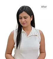 1.5" X 3" Scalp-Topper