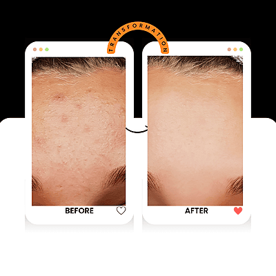 Tribe Route Seabuckthorn Serum, Natural Face Oil with Hyaluronic Acid, Vitamin E, Rosehip Oil