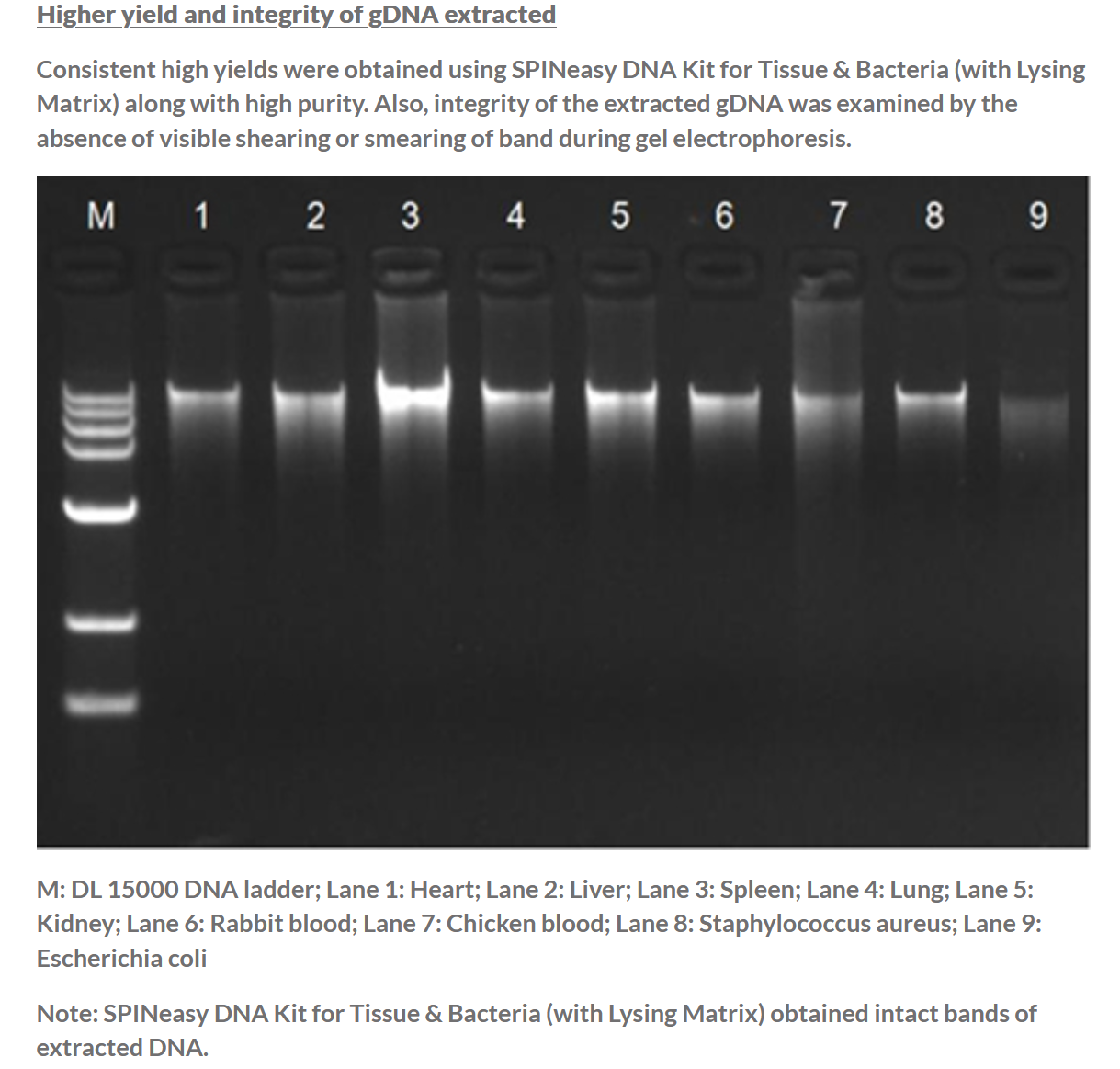 SPINeasy® DNA Kit for Tissue & Bacteria (With Lysing Matrix) 50preps MP