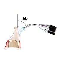 EndoKing Prophyshine Air Polisher – Dental Air Polishing Handpiece