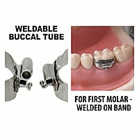 OSL 1st Molar Weldable Buccal Tubes MBT 0.022 (Pack of 4)