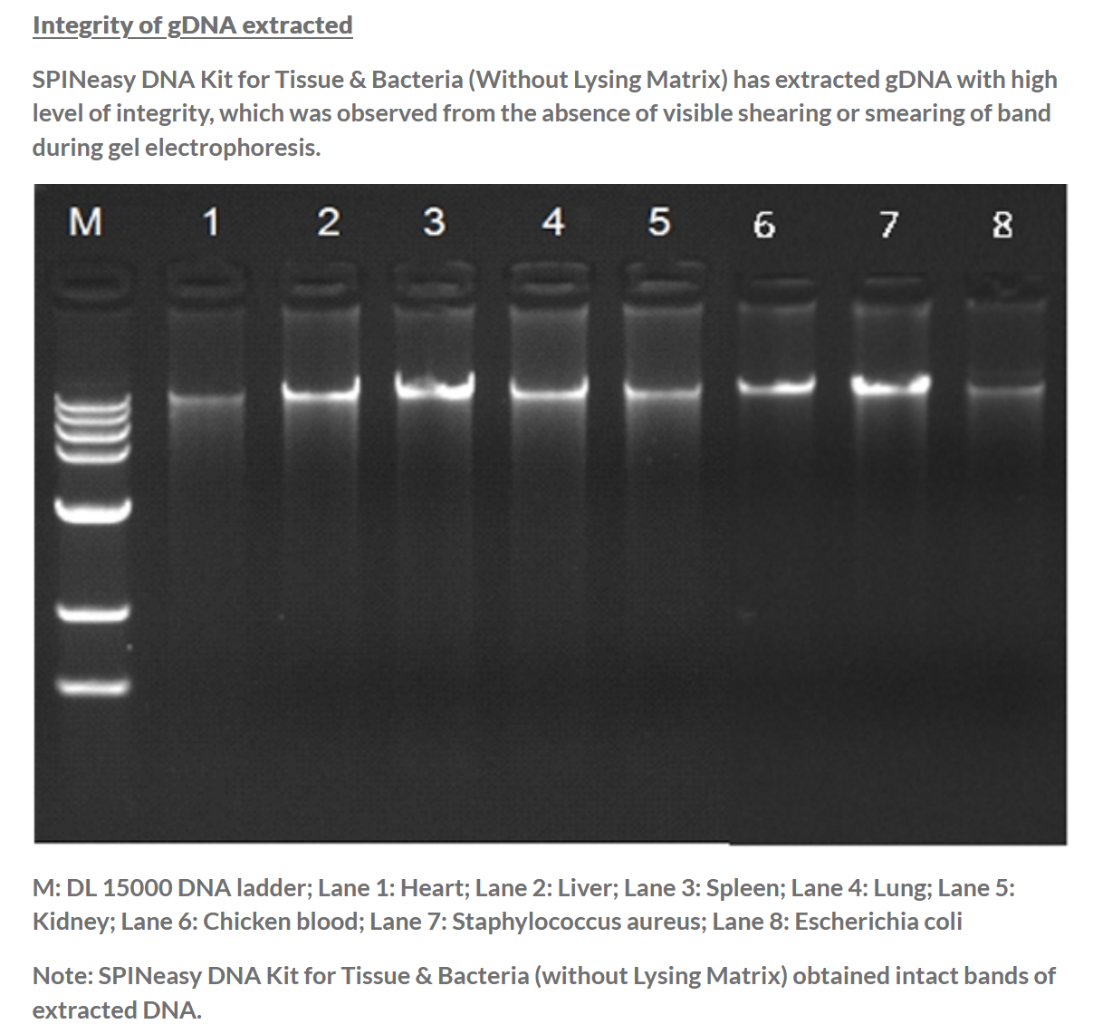 SPINeasy® DNA Kit for Tissue & Bacteria (Without Lysing Matrix) 50preps MP