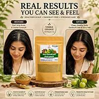 Harsha Naturals - Anti Dandruff Hair pack - 100 gms