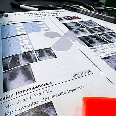 NPrep Rapid Revision 2.0 Printed Book for NORCET, KGMU & CHO Nursing Exams – Paperback Edition