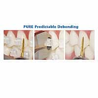 UU Ortho Mono Crystalline Sapphire Transparent Ceramic Brackets