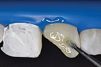 Cotisen Dental Micro Applicators Tips – Disposable Micro Brush Applicators