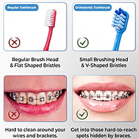MyOra C-Soft Orthodontic Toothbrush for Braces – Pack of 12