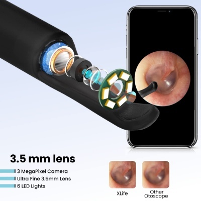 Portronics Xlife Smart Wireless Ear Otoscope Cleaner with 6 LED Lights,Control Via App (Black) Portronics Xlife Smart Wireless Ear Otoscope Cleaner with 6 LED Lights,Control Via App (Black)