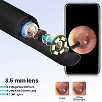 Portronics Xlife is a wireless ear otoscope, connecting to smartphones for real-time video, high-resolution images, and easy ear cleaning.