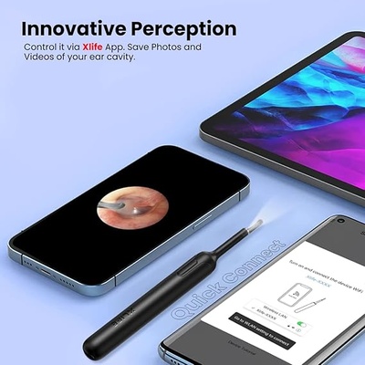 Portronics Xlife Smart Wireless Ear Otoscope Cleaner with 6 LED Lights,Control Via App (Black) Portronics Xlife Smart Wireless Ear Otoscope Cleaner with 6 LED Lights,Control Via App (Black)