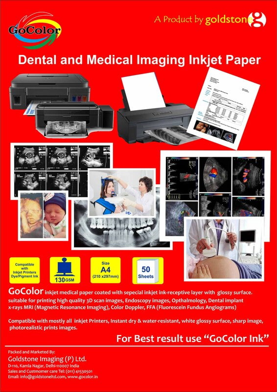 Inkjet Paper for Dental & Medical Imaging - 3D Scan, Endoscory Images, Dental Implant, X Ray MRI, Color Droppler, FFA etc A4 Size 130 GSM 50 Sheet Pack