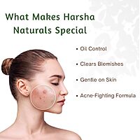 Harsha Naturals Anti Acne Face Cream - 50 gms