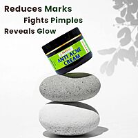 Harsha Naturals Anti Acne Face Cream - 50 gms