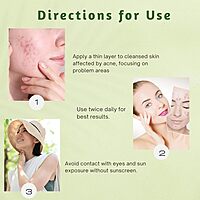 Harsha Naturals Anti Acne Face Cream - 50 gms