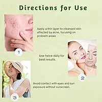 Harsha Naturals Anti Acne Face Cream - 50 gms