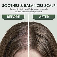 Harsha Naturals - Anti Dandruff Oil 200ml