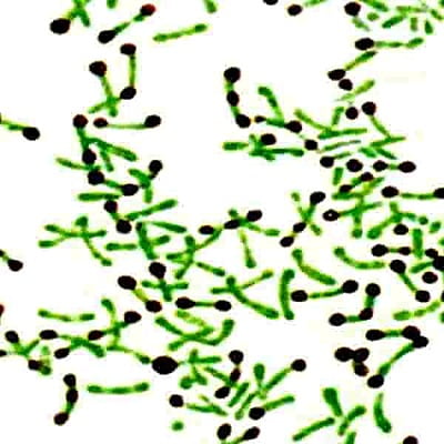 Albert Stain A solution 500 ml CAS #