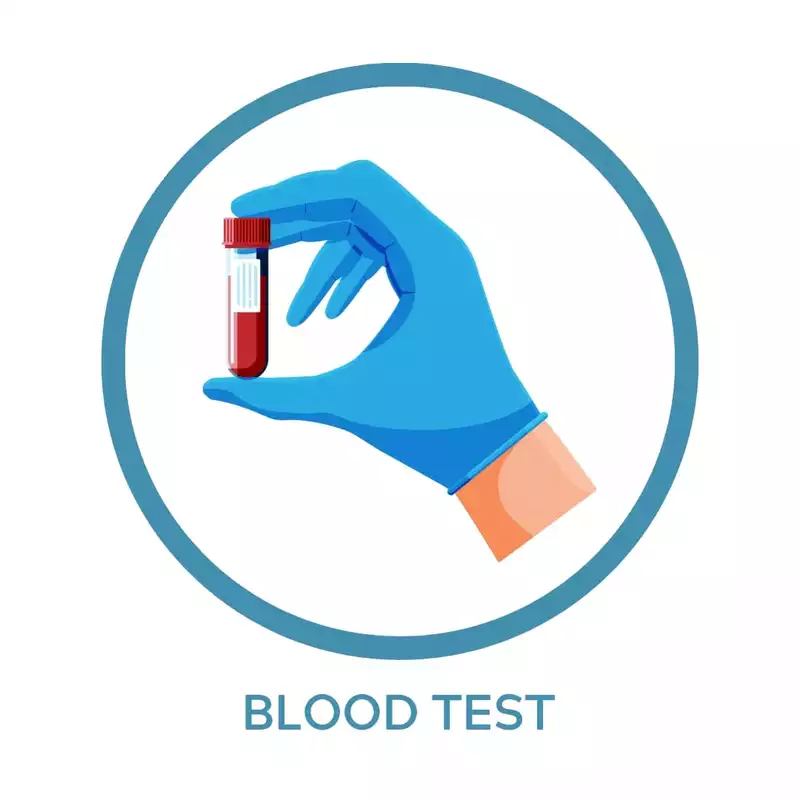 HBV Viral Load by Real time PCR