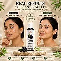 Charcoal Face Wash - 100 ml