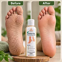 Diabetic Foot Care Lotion