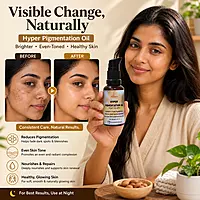 Harsha Naturals - Hyperpigmentation Serum