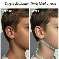 Harsha Naturals Dark Neck Lotion - 100 ml