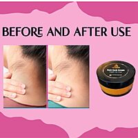 Harsha Naturals - Dark Neck Cream