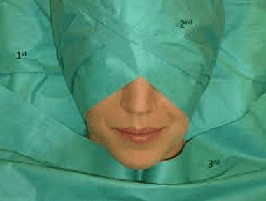 Dermatology Surgical Drapes