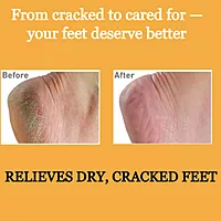 Harsha Naturals Foot Cream - 50 gms