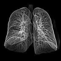 Inkjet medical Canon Ink 500ML Black