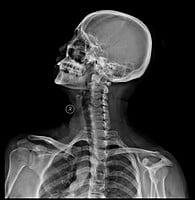 Inkjet medical Canon Ink 500ML Black