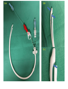 Hemodialysis Catheter (Temporary / Permanent)