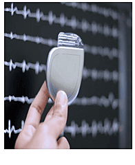 Implantable Cardioverter Defibrillator (ICD)