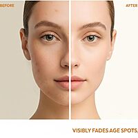 Harsha Naturals - Kojic Soap