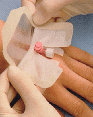 MADORED Transparent Dressing Pad