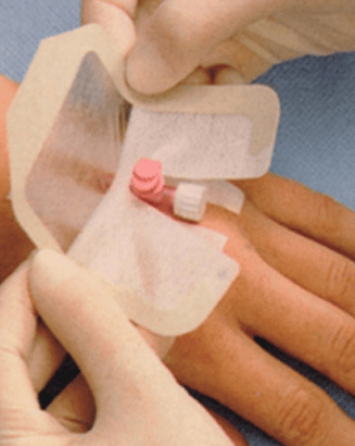 MADORED Transparent Dressing Pad