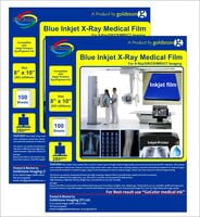 Inkjet Medical Blue Film for X Ray imaging/Waterproof Film/SIZE: 203mm x 254mm (8 inch X 10 inch) X 20 Sheet Pack of 280 GSM / 210 Micron PACK OF 2 Packts Inkjet Medical Blue Film for X Ray imaging/Waterproof Film/SIZE: 203mm x 254mm (8 inch X 10 inch) X 20 Sheet Pack of 280 GSM / 210 Micron PACK OF 2 Packts