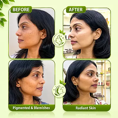 Manjistha Spot Lightening Cream