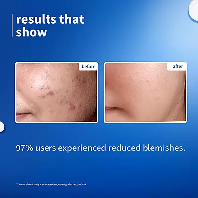 Plum Niacinamide Serum