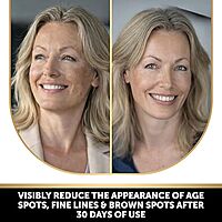 Harsha Naturals - Pigmentation soap