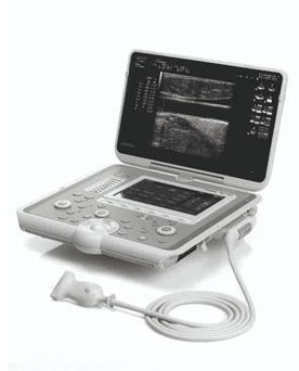 Portable Echocardiogram (Ultrasound)