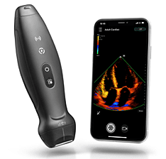Portable Ultrasound Scanner (Handheld)