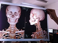 Inkjet Medical WHITE Film 8"X10" DR/CR/MRI/CT Imaging Film 175 Micron / 240 gsm 100 SHEETS Inkjet Medical WHITE Film 8"X10" DR/CR/MRI/CT Imaging Film 175 Micron / 240 gsm 100 SHEETS